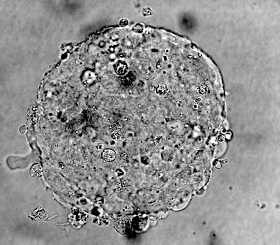 Stem Cells and Regeneration